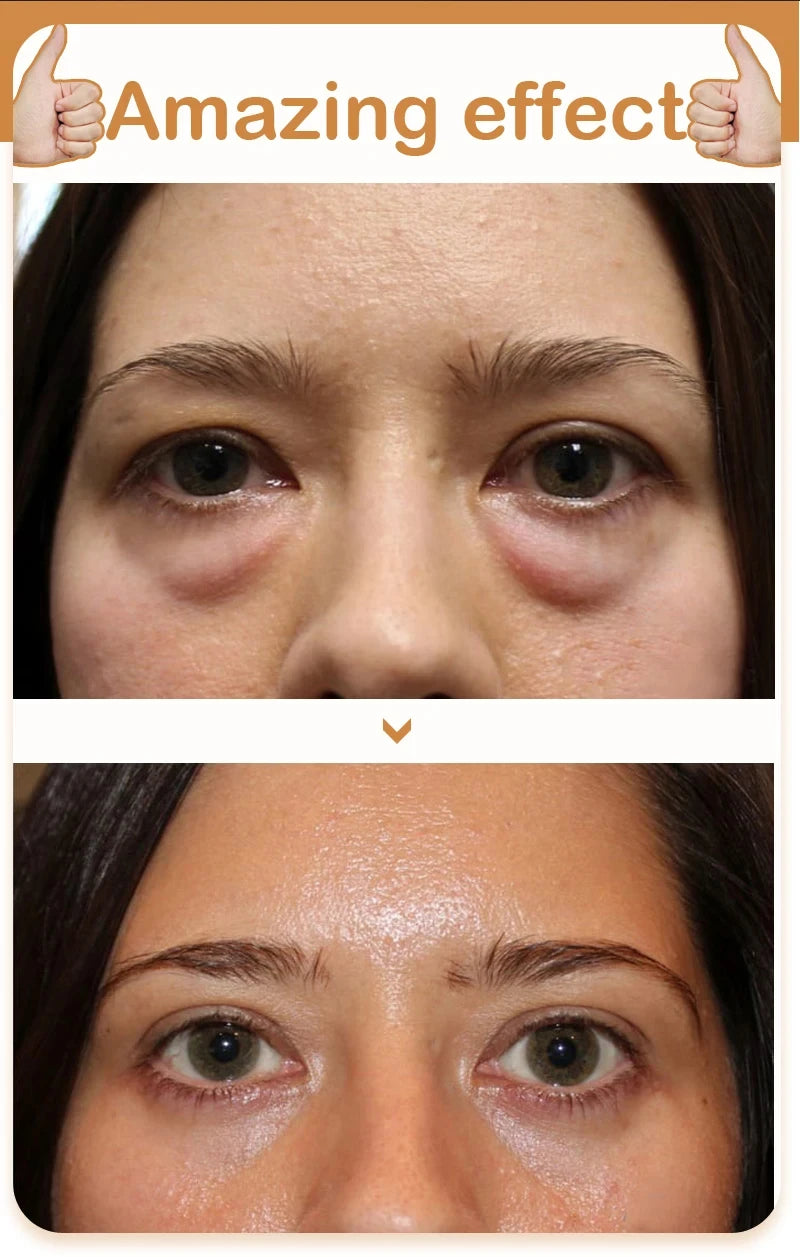 Eye Bags Cream Improve Eyes Wrinkle