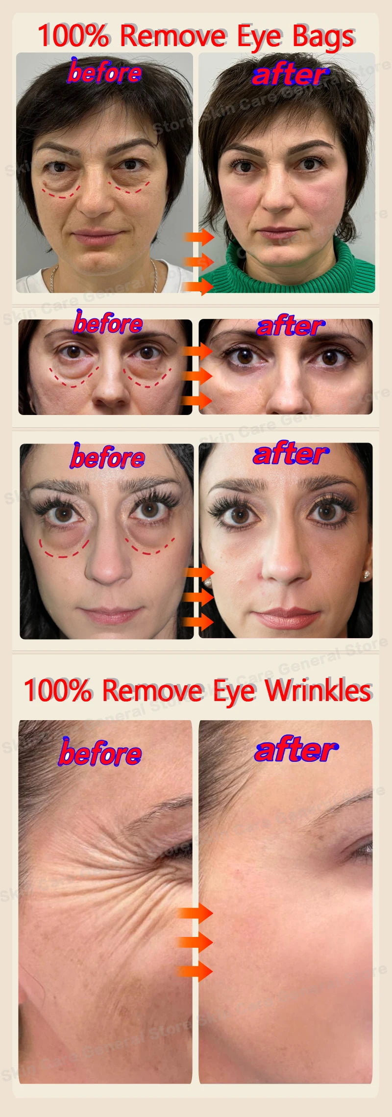 Eye Bags Cream Improve Eyes Wrinkle